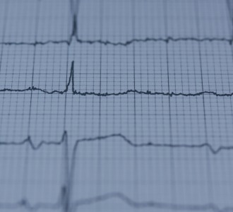Exame Florianópolis ECG